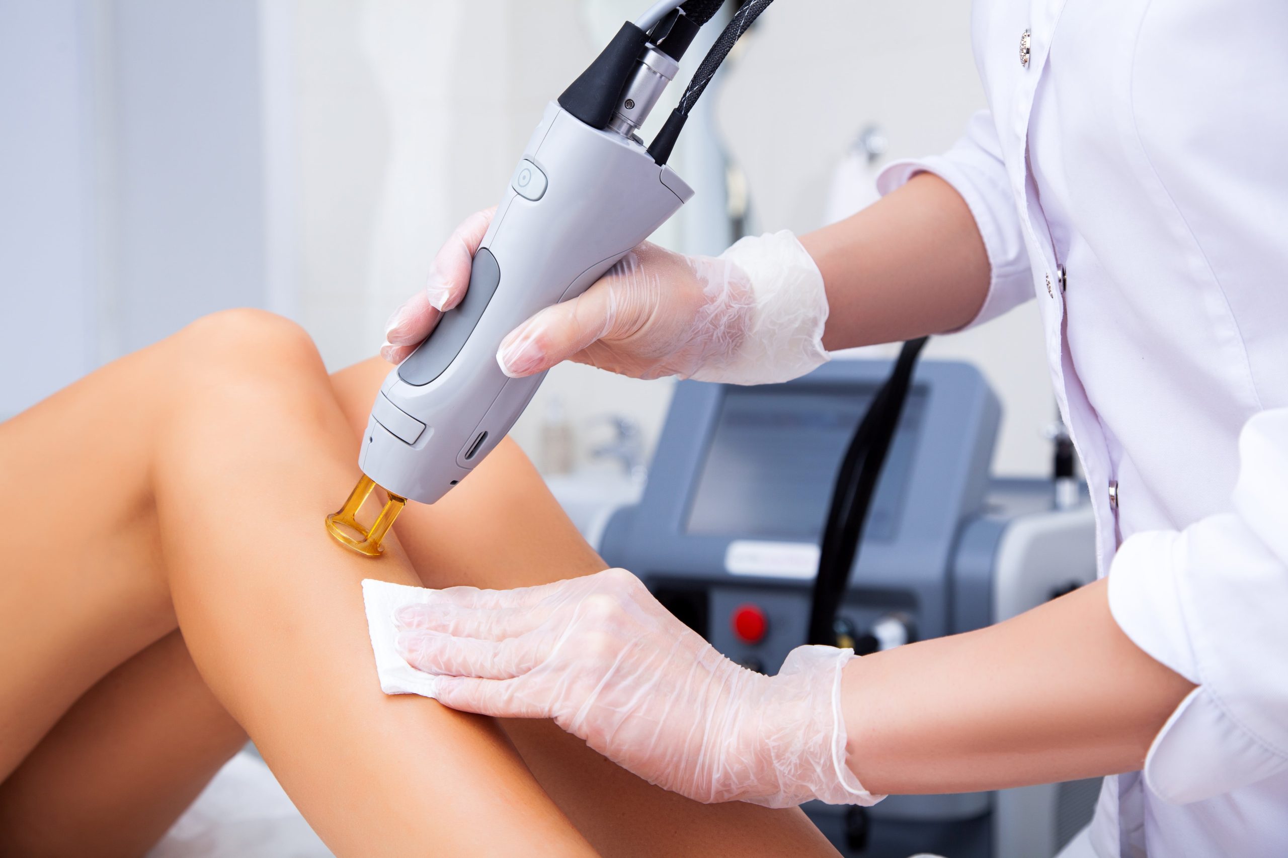 Laser hair removal treatment at BGY Skin Aesthetics and Spa in Jupiter, FL. Experience smooth, hair-free skin with our quick, painless, and effective procedure.