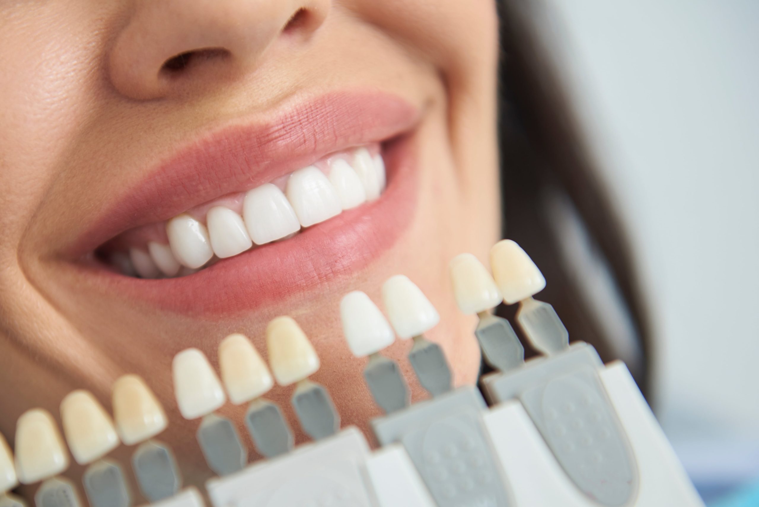 Achieve a dazzling smile with our professional teeth whitening treatment at BGY Skin Aesthetics and Spa in Jupiter, FL.