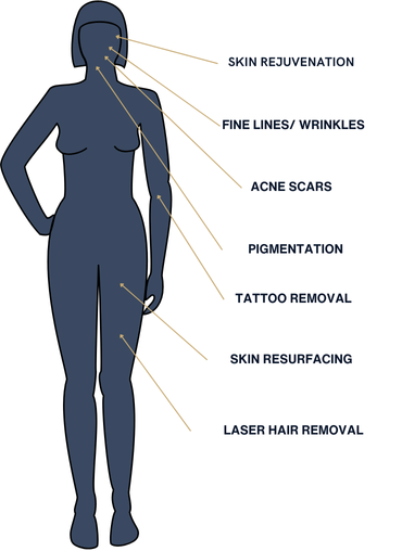 Laser Tattoo Removal